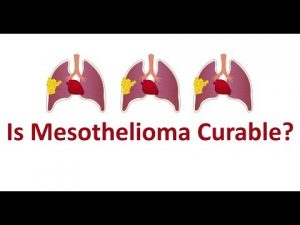 Everything About Mesothelioma Explained