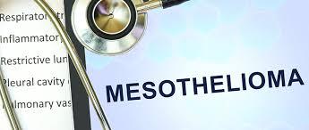 Top Mesothelioma Treatment Options To Consider